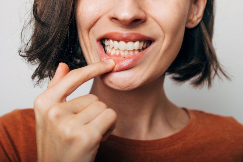 Lady shows teeth and gums