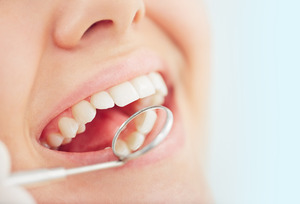 Close-up of patient having teeth examined with mirror